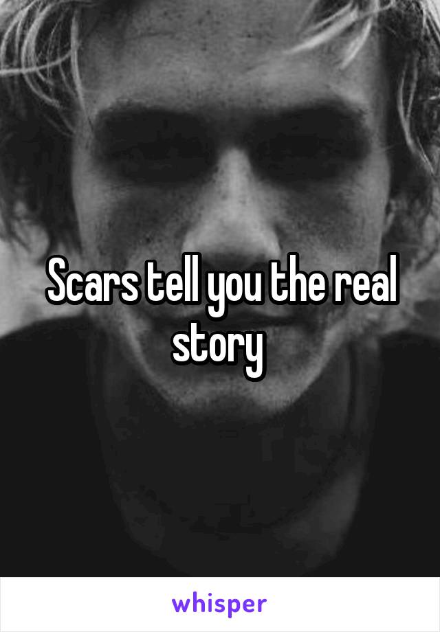 Scars tell you the real story 
