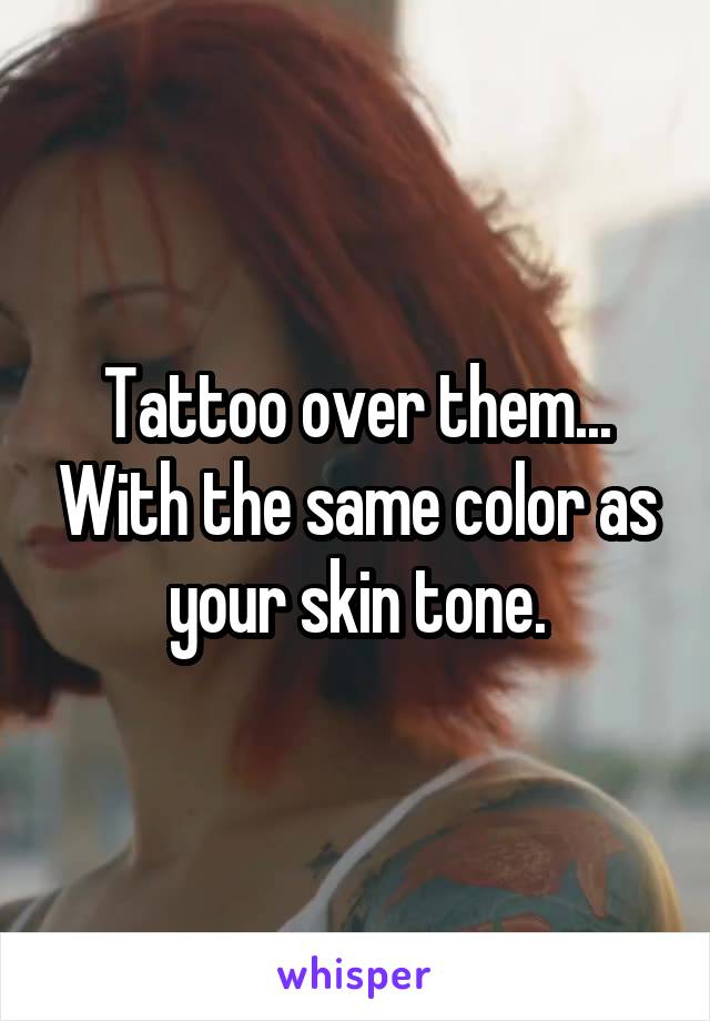 Tattoo over them... With the same color as your skin tone.