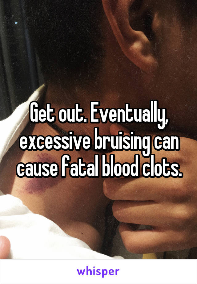 Get out. Eventually, excessive bruising can cause fatal blood clots.