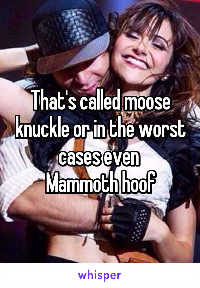 That's called moose knuckle or in the worst cases even 
Mammoth hoof