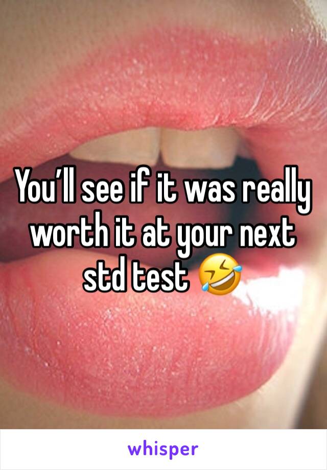 You’ll see if it was really worth it at your next std test 🤣