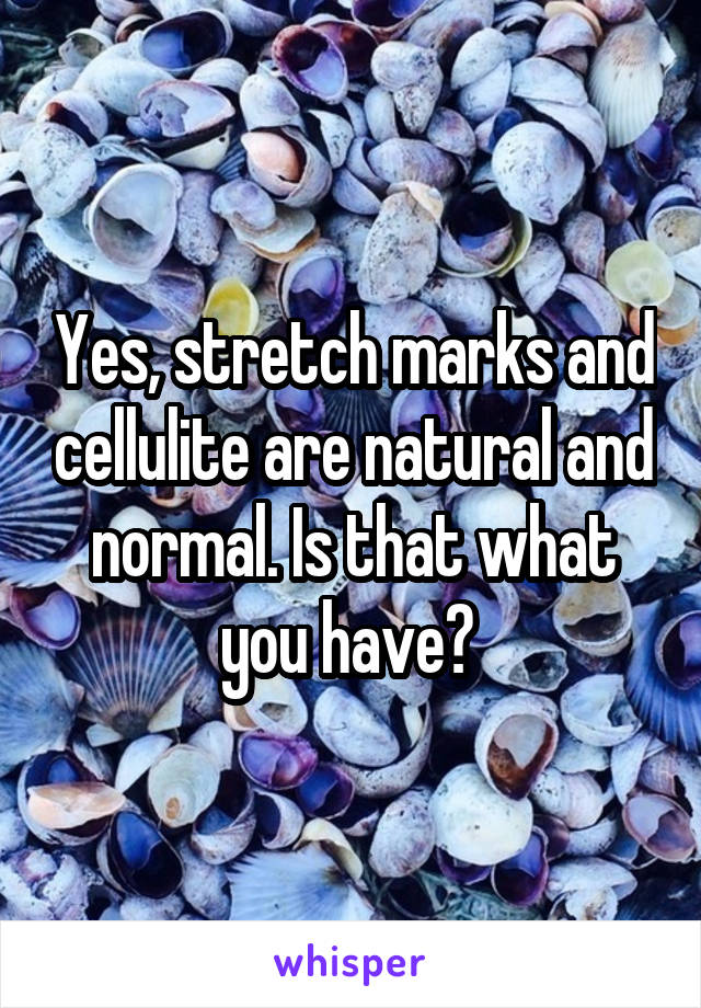 Yes, stretch marks and cellulite are natural and normal. Is that what you have? 