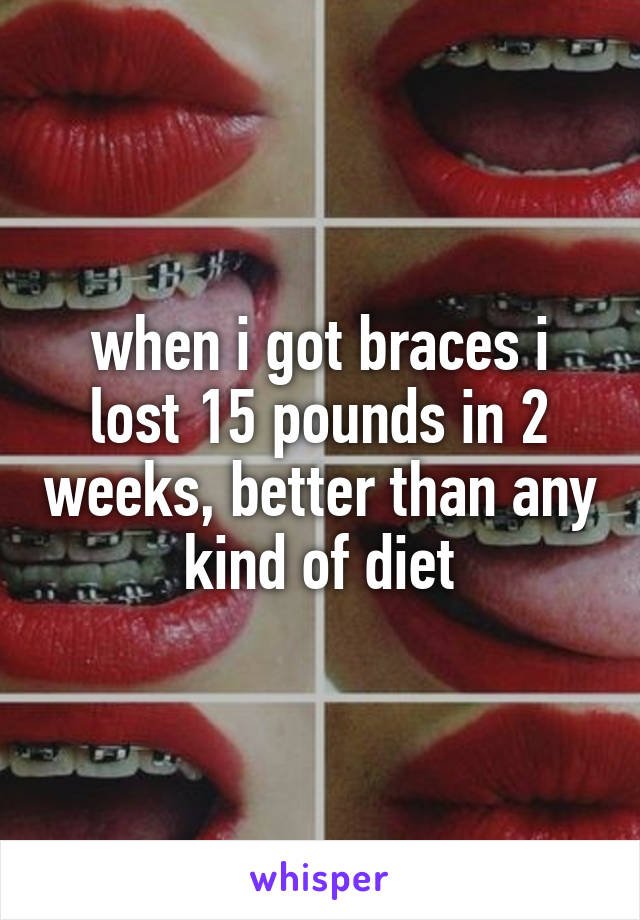 when i got braces i lost 15 pounds in 2 weeks, better than any kind of diet