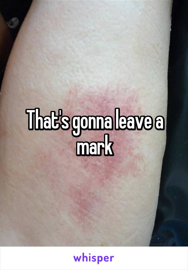 That's gonna leave a mark