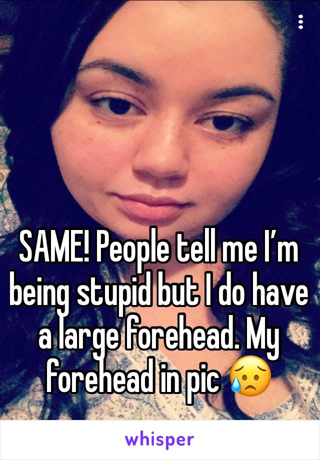 



SAME! People tell me I’m being stupid but I do have a large forehead. My forehead in pic 😥