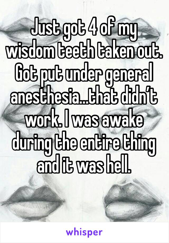 Just got 4 of my wisdom teeth taken out. Got put under general anesthesia...that didn’t work. I was awake during the entire thing and it was hell.