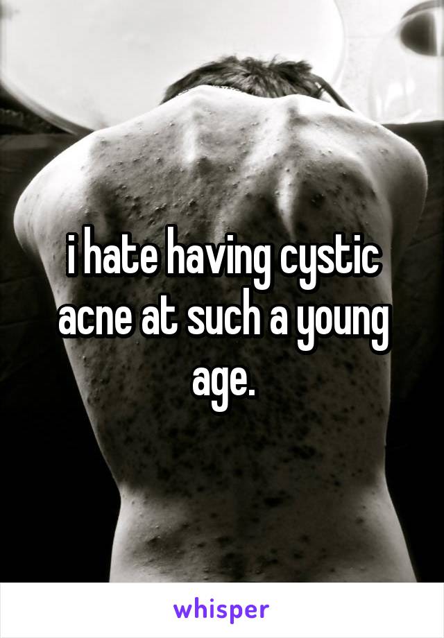 i hate having cystic acne at such a young age.