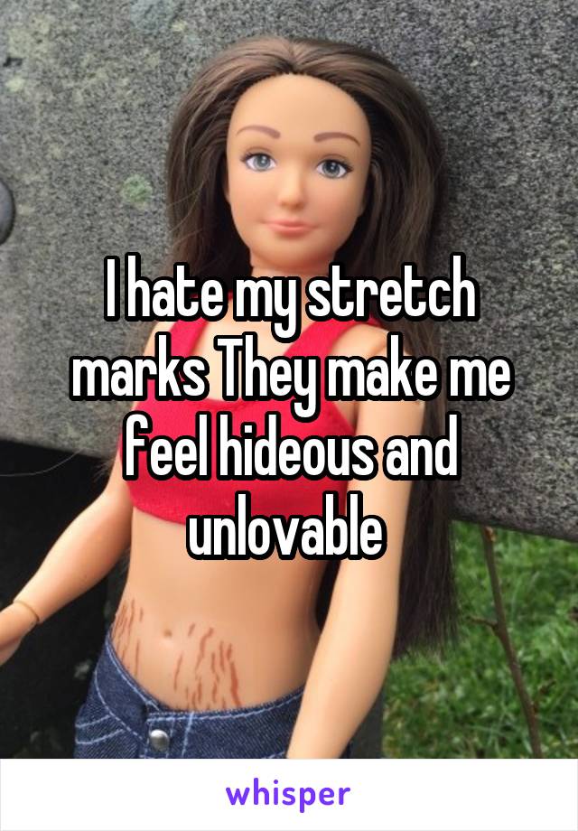 I hate my stretch marks They make me feel hideous and unlovable 