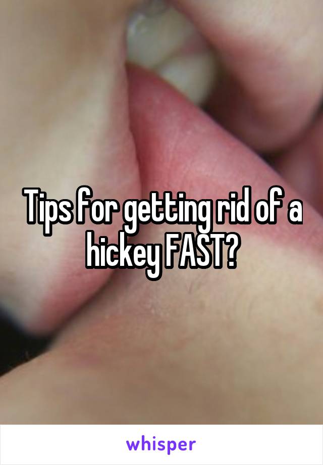 Tips for getting rid of a hickey FAST?