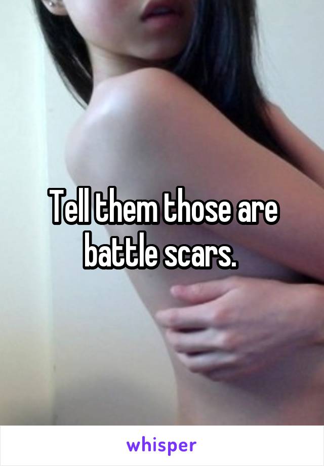 Tell them those are battle scars. 