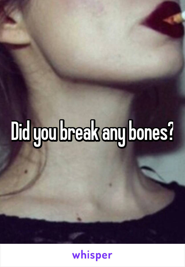 Did you break any bones?