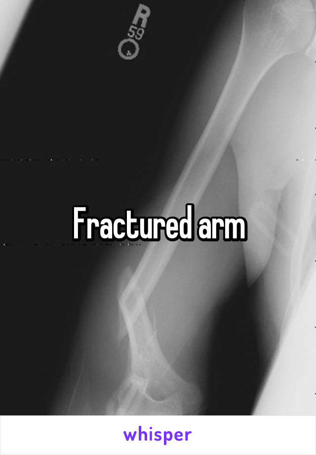 Fractured arm