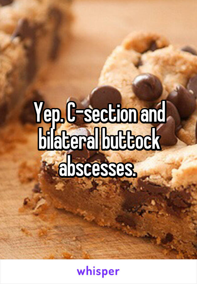 Yep. C-section and bilateral buttock abscesses. 