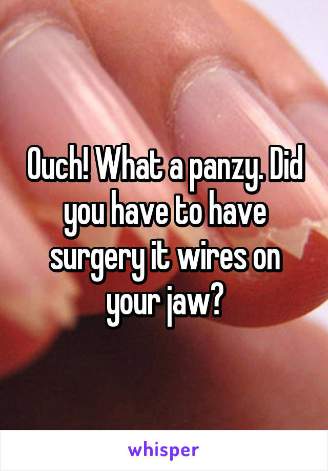 Ouch! What a panzy. Did you have to have surgery it wires on your jaw?