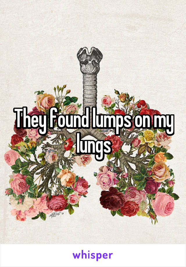 They found lumps on my lungs