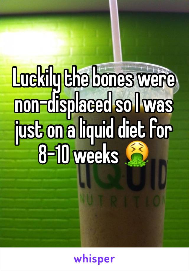 Luckily the bones were non-displaced so I was just on a liquid diet for 8-10 weeks 🤮