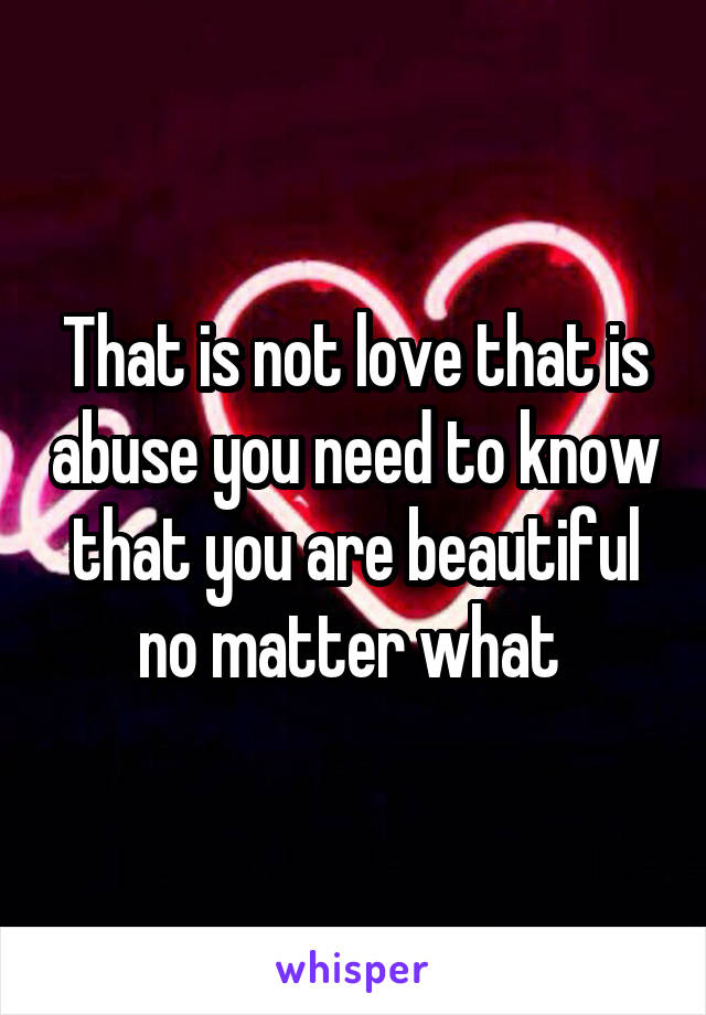 That is not love that is abuse you need to know that you are beautiful no matter what 