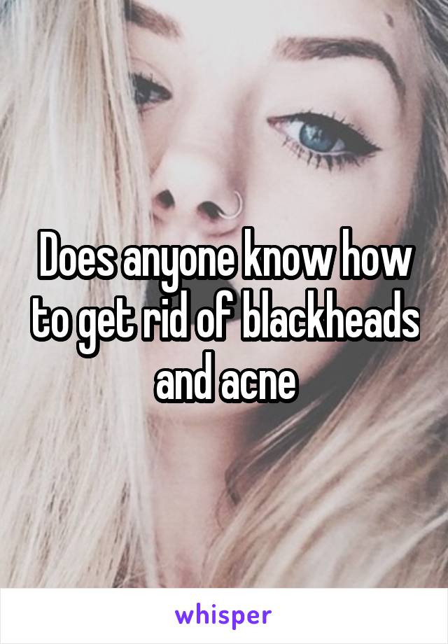 Does anyone know how to get rid of blackheads and acne