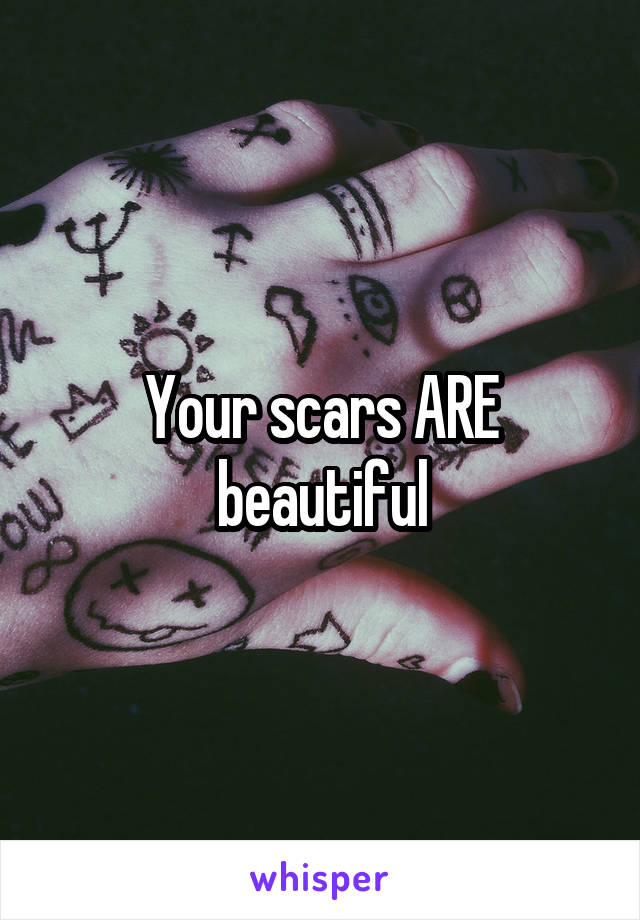 Your scars ARE beautiful