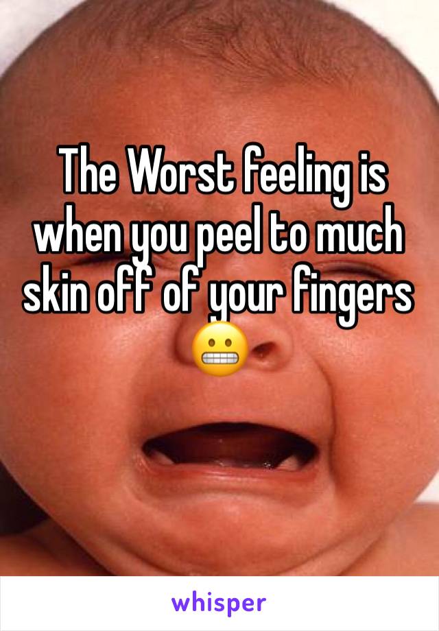  The Worst feeling is when you peel to much skin off of your fingers 😬