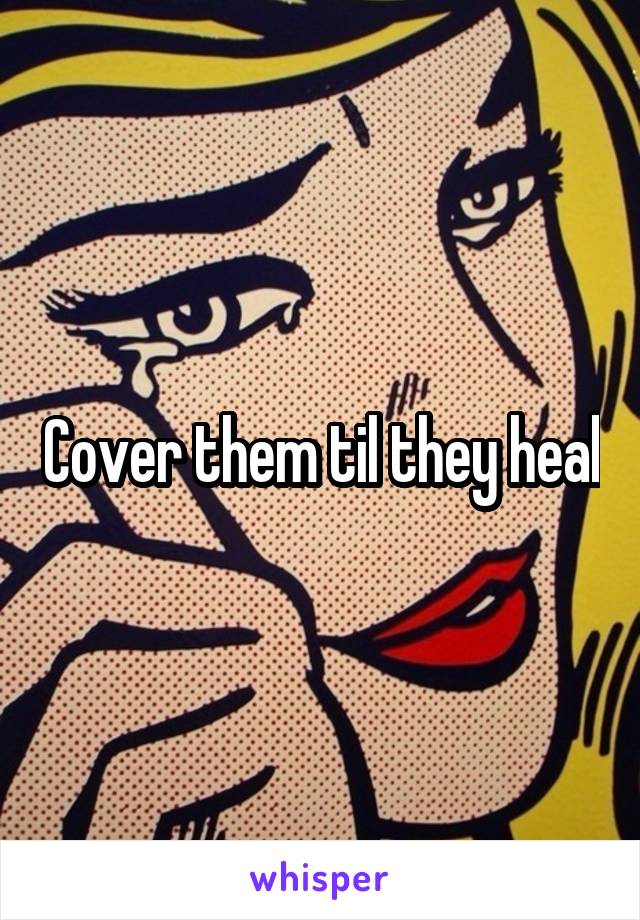 Cover them til they heal