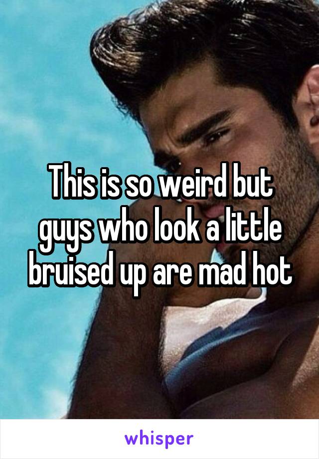 This is so weird but guys who look a little bruised up are mad hot