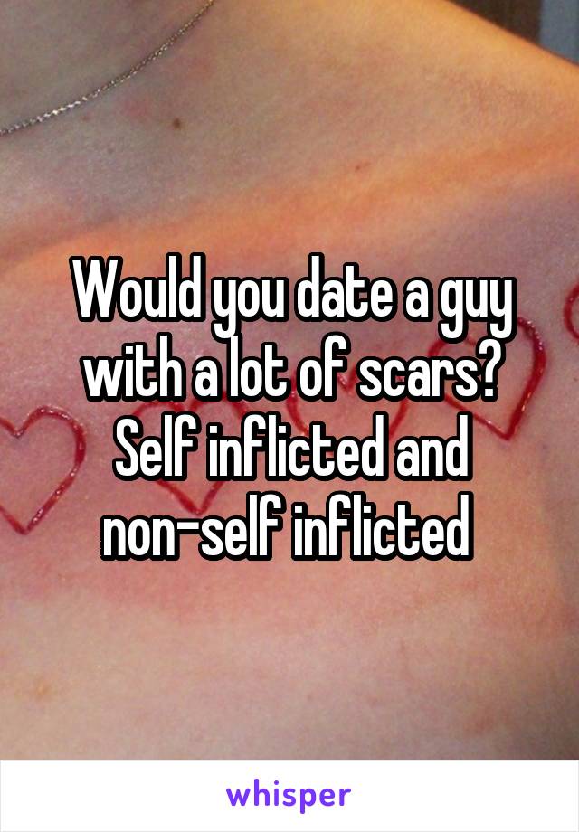 Would you date a guy with a lot of scars? Self inflicted and non-self inflicted 