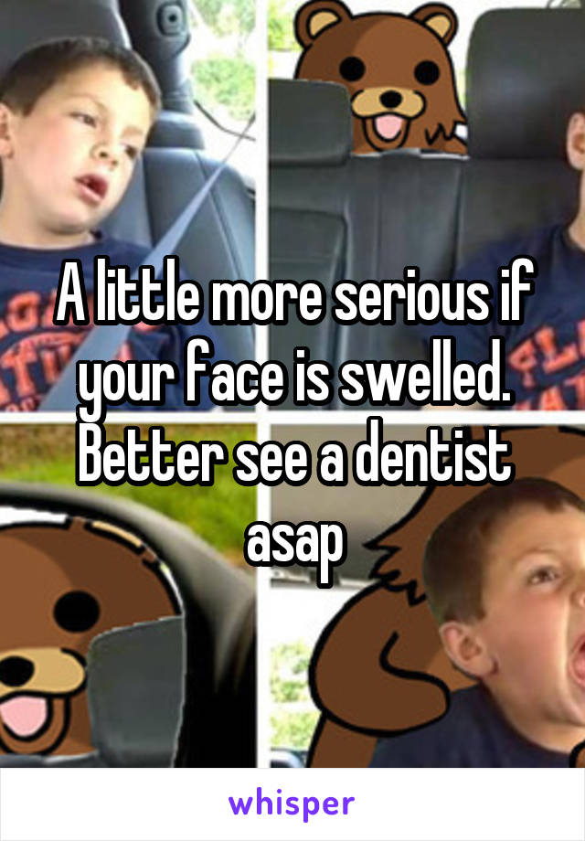 A little more serious if your face is swelled. Better see a dentist asap