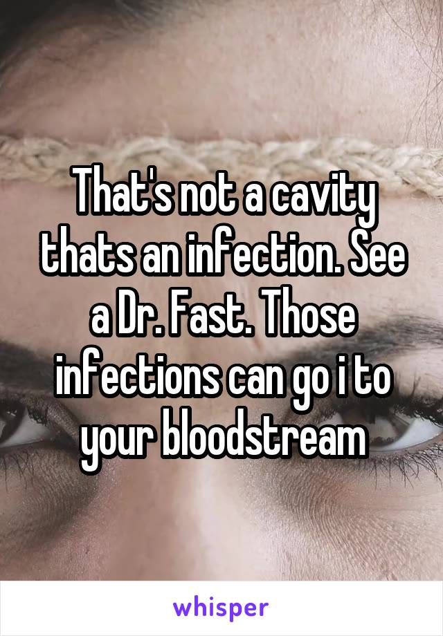 That's not a cavity thats an infection. See a Dr. Fast. Those infections can go i to your bloodstream