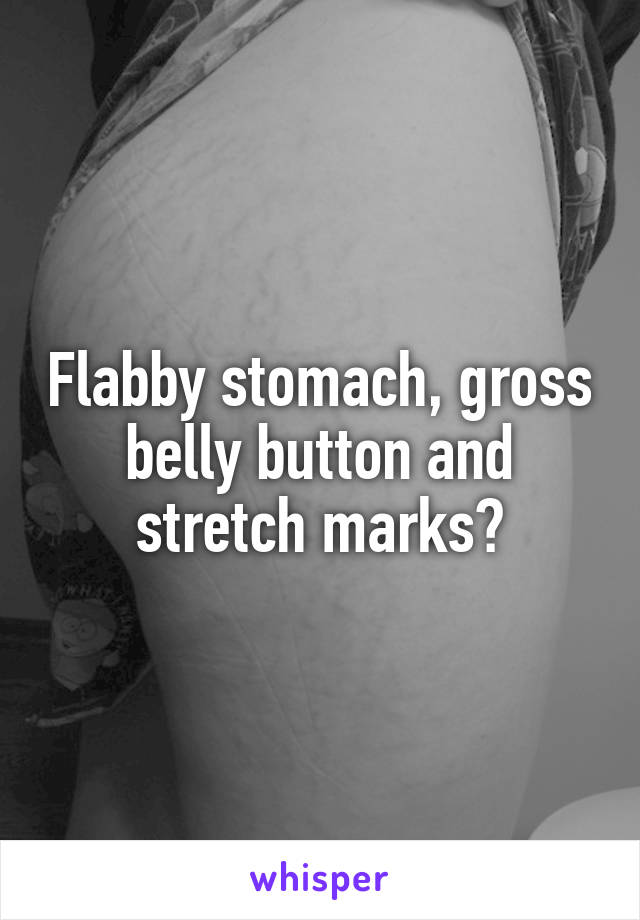 Flabby stomach, gross belly button and stretch marks?