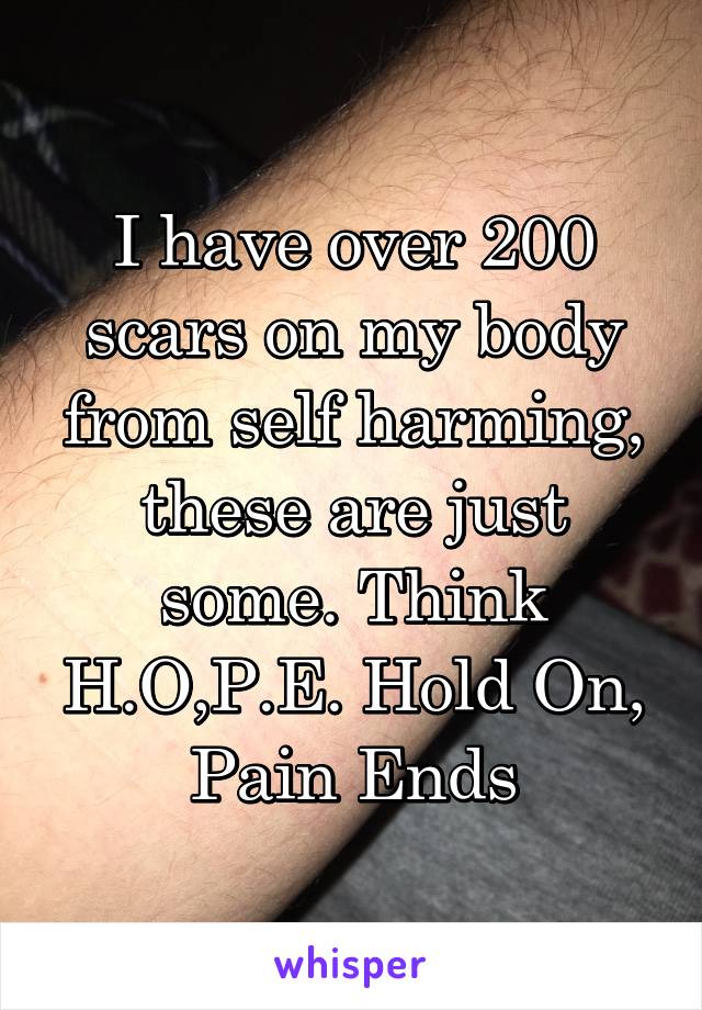I have over 200 scars on my body from self harming, these are just some. Think H.O,P.E. Hold On, Pain Ends