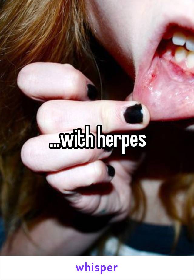 ...with herpes