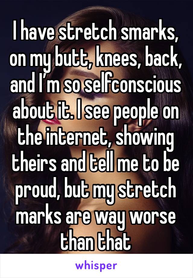 I have stretch smarks, on my butt, knees, back, and I’m so selfconscious about it. I see people on the internet, showing theirs and tell me to be proud, but my stretch marks are way worse than that