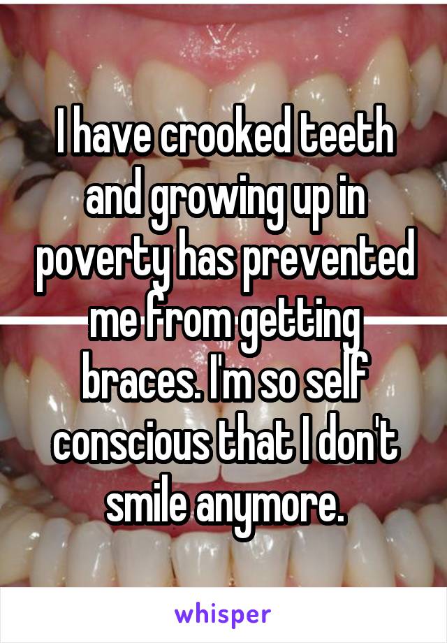 I have crooked teeth and growing up in poverty has prevented me from getting braces. I'm so self conscious that I don't smile anymore.