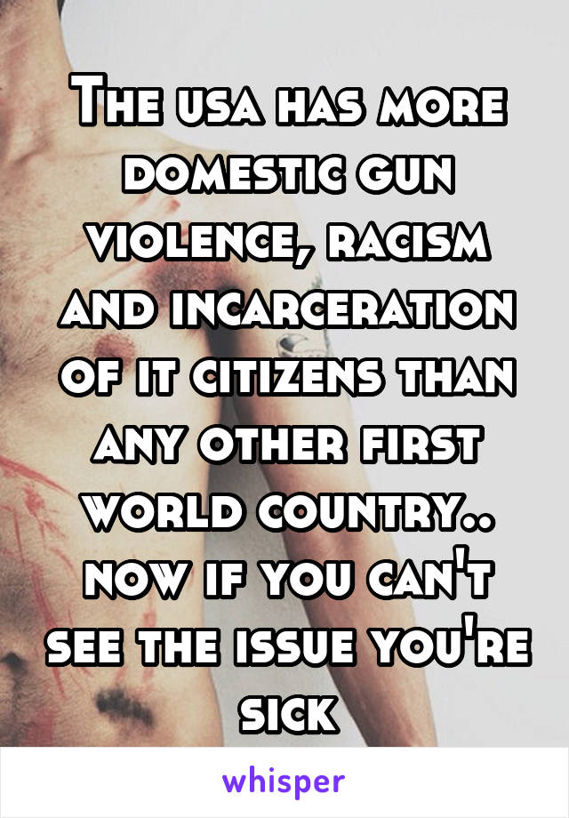 The usa has more domestic gun violence, racism and incarceration of it citizens than any other first world country.. now if you can't see the issue you're sick