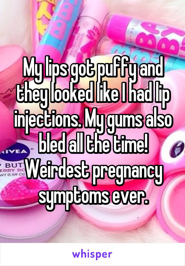 My lips got puffy and they looked like I had lip injections. My gums also bled all the time! Weirdest pregnancy symptoms ever.