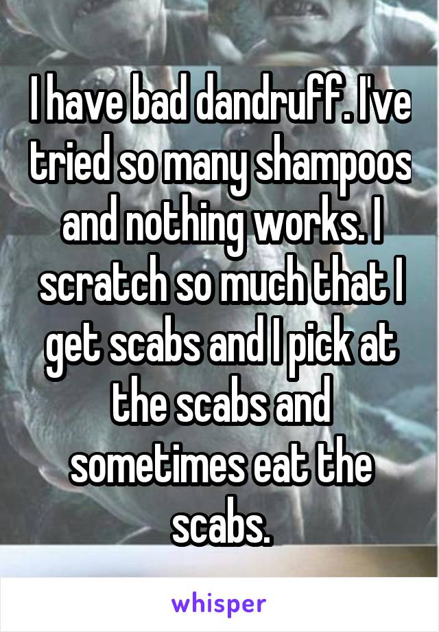 I have bad dandruff. I've tried so many shampoos and nothing works. I scratch so much that I get scabs and I pick at the scabs and sometimes eat the scabs.