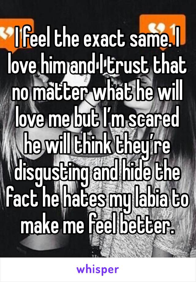 I feel the exact same. I love him and I trust that no matter what he will love me but I’m scared he will think they’re disgusting and hide the fact he hates my labia to make me feel better.