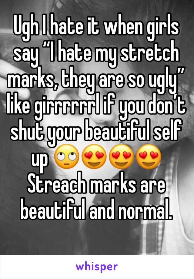 Ugh I hate it when girls say “I hate my stretch marks, they are so ugly” like girrrrrrl if you don’t shut your beautiful self up 🙄😍😍😍 Streach marks are beautiful and normal.