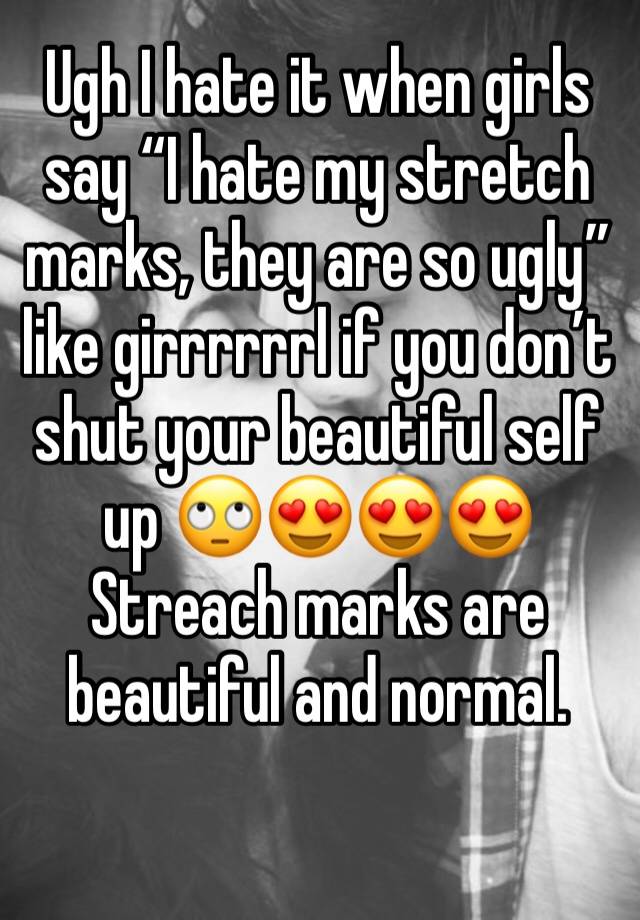 Ugh I hate it when girls say “I hate my stretch marks, they are so ugly” like girrrrrrl if you don’t shut your beautiful self up 🙄😍😍😍 Streach marks are beautiful and normal.