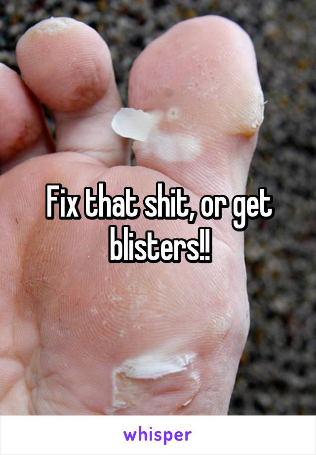 Fix that shit, or get blisters!!