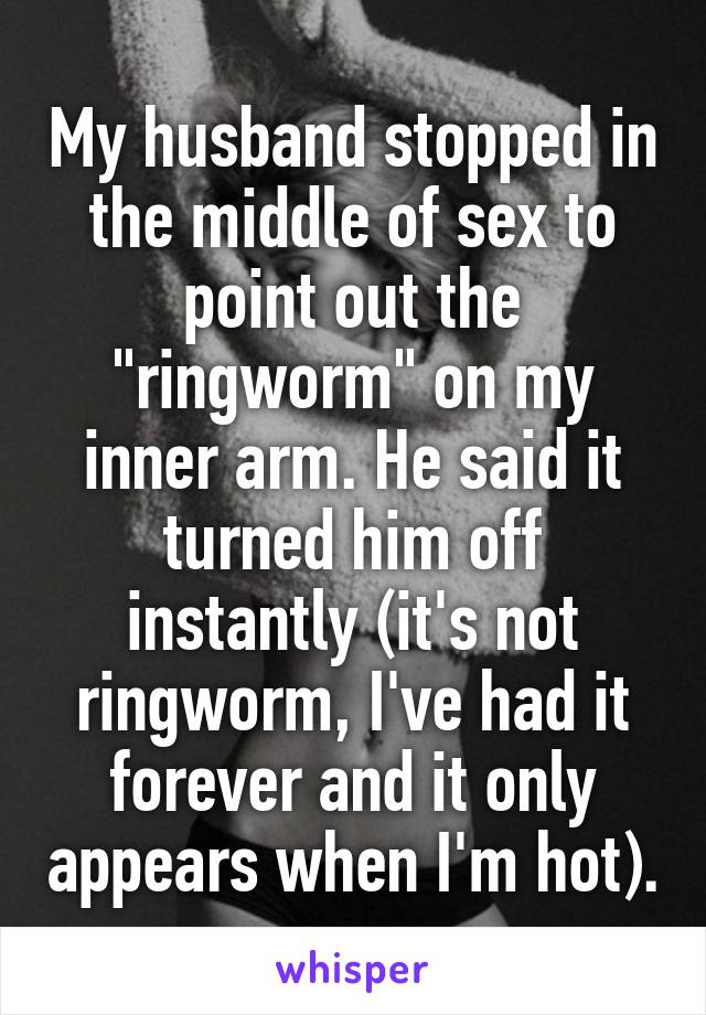 My husband stopped in the middle of sex to point out the "ringworm" on my inner arm. He said it turned him off instantly (it's not ringworm, I've had it forever and it only appears when I'm hot).