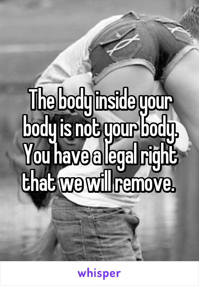 The body inside your body is not your body. You have a legal right that we will remove. 