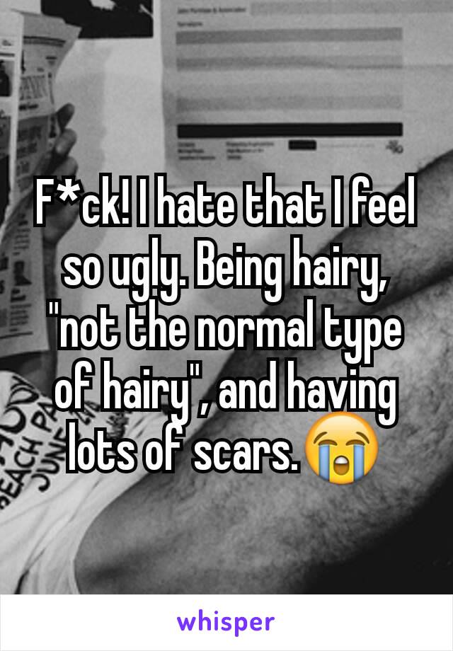 F*ck! I hate that I feel so ugly. Being hairy, "not the normal type of hairy", and having lots of scars.😭