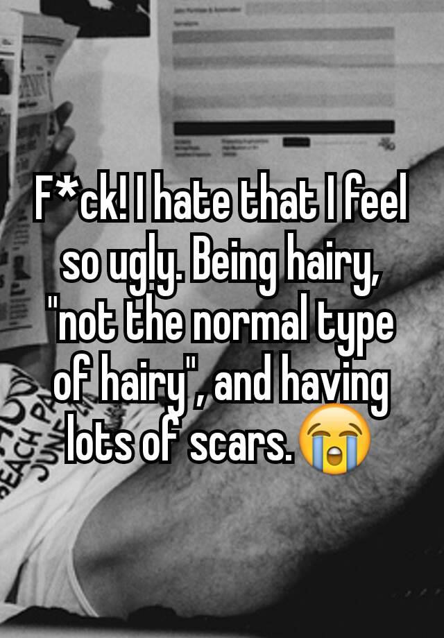 F*ck! I hate that I feel so ugly. Being hairy, "not the normal type of hairy", and having lots of scars.😭