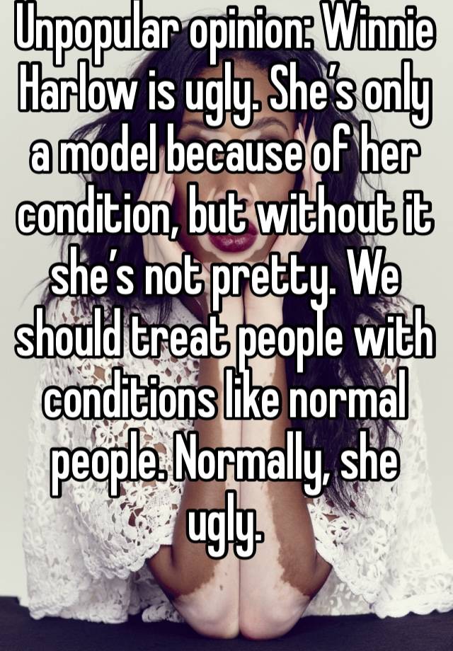 Unpopular opinion: Winnie Harlow is ugly. She’s only a model because of her condition, but without it she’s not pretty. We should treat people with conditions like normal people. Normally, she ugly. 