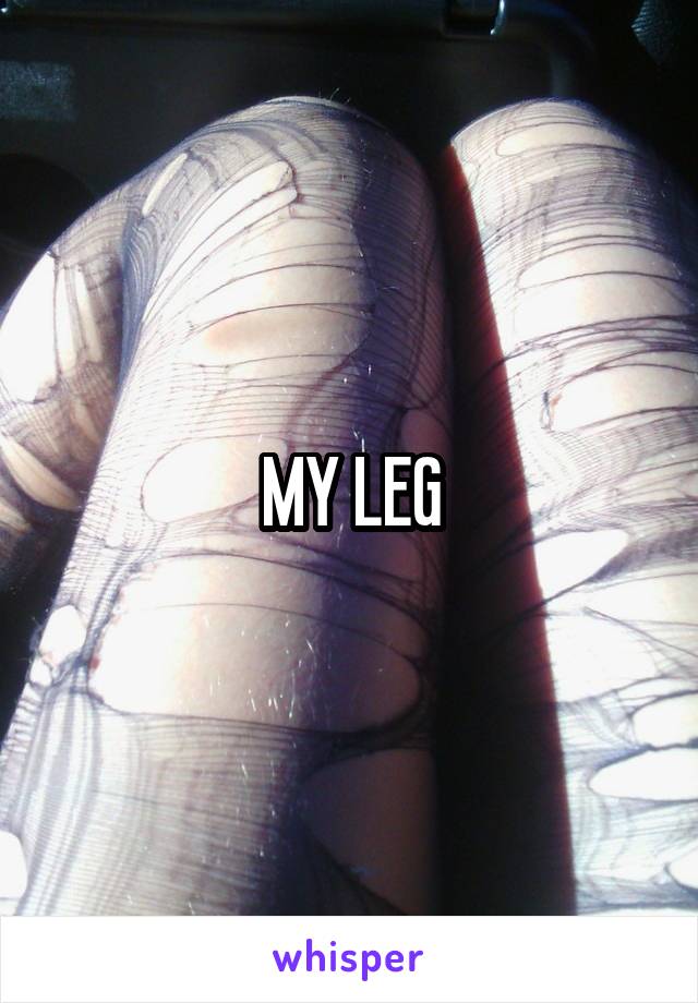 MY LEG