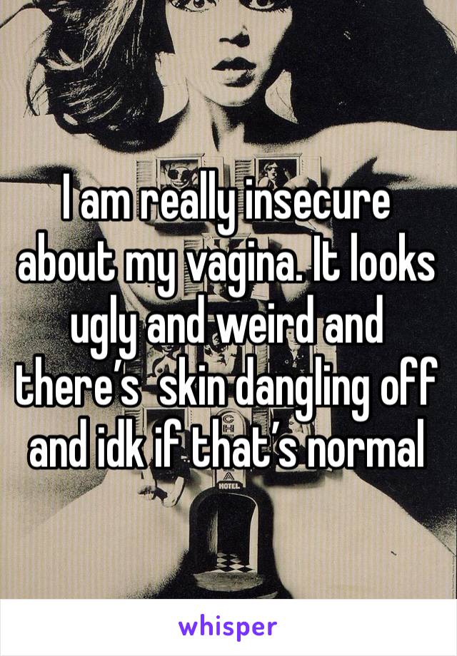 I am really insecure about my vagina. It looks ugly and weird and there’s  skin dangling off and idk if that’s normal