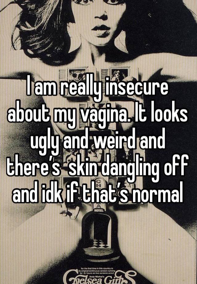 I am really insecure about my vagina. It looks ugly and weird and there’s  skin dangling off and idk if that’s normal