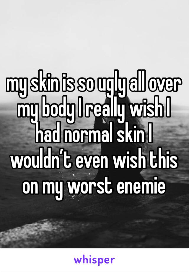 my skin is so ugly all over my body I really wish I had normal skin I wouldn’t even wish this on my worst enemie 